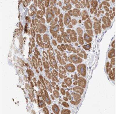 Immunohistochemistry-Paraffin: CaMKII beta Antibody [NBP1-88212] - Staining of human heart shows weak to moderate cytoplasmic positivity in cardiomyocytes.