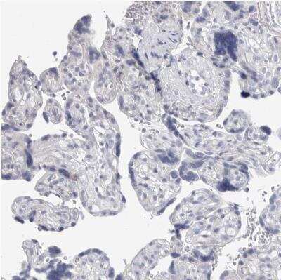 Immunohistochemistry-Paraffin: CaMKII beta Antibody [NBP1-88212] -  Staining of human placenta shows no positivity in trophoblastic cells as expected.