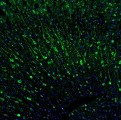 Immunohistochemistry: CaMKII beta Antibody [NBP1-88212] - Staining of mouse brain shows moderate to strong positivity in more than 75 % of neurons in the cerebral cortex.