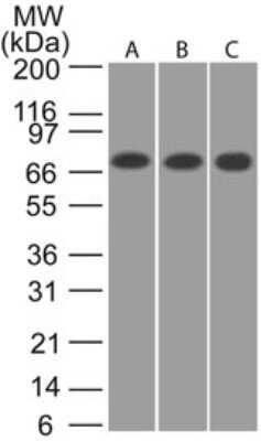 Western Blot: CaMKII beta Antibody [NB120-22131] - Analysis of CAMKII beta in A) human, B) mouse and C) rat brain lysate using CAMKII beta antibody at 1:2000.