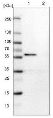 <b>Orthogonal Strategies Validation. </b>Western Blot: CaMKII beta Antibody [NBP1-88212] - Lane 1: NIH-3T3 cell lysate (Mouse embryonic fibroblast cells)  Lane 2: NBT-II cell lysate (Rat Wistar bladder tumour cells)