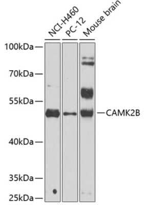 Western Blot: CaMKII beta Antibody [NBP2-92193] - Analysis of extracts of various cell lines, using CaMKII beta at 1:1000 dilution.Secondary antibody: HRP Goat Anti-Rabbit IgG (H+L) at 1:10000 dilution.Lysates/proteins: 25ug per lane.Blocking buffer: 3% nonfat dry milk in TBST.Detection: ECL Basic Kit .Exposure time: 90s.