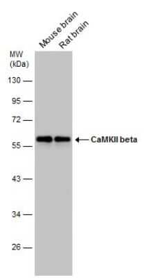 Western Blot: CaMKII beta Antibody [NBP3-13157] - Various tissue extracts (30 ug) were separated by 10% SDS-PAGE, and the membrane was blotted with CaMKII beta antibody (NBP3-13157) diluted at 1:1000.