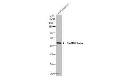 Western Blot: CaMKII beta Antibody [NBP3-13157] - Human tissue extract (30 ug) was separated by 10% SDS-PAGE, and the membrane was blotted with CaMKII beta antibody (NBP3-13157) diluted at 1:500. The HRP-conjugated anti-rabbit IgG antibody (NBP2-19301) was used to detect the primary antibody.