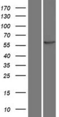 Western Blot: CaMKII beta Overexpression Lysate (Adult Normal) [NBP2-05191] Left-Empty vector transfected control cell lysate (HEK293 cell lysate); Right -Over-expression Lysate for CaMKII beta.