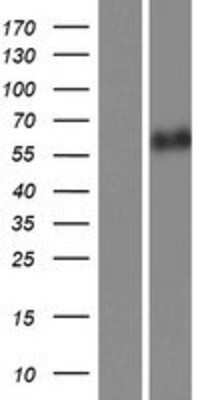 Western Blot CaMKII beta Overexpression Lysate