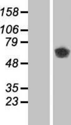 Western Blot: CaMKII beta Overexpression Lysate (Adult Normal) [NBP2-05193] Left-Empty vector transfected control cell lysate (HEK293 cell lysate); Right -Over-expression Lysate for CaMKII beta.