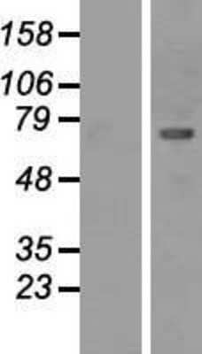 Western Blot: CaMKII beta Overexpression Lysate (Adult Normal) [NBP2-10965] Left-Empty vector transfected control cell lysate (HEK293 cell lysate); Right -Over-expression Lysate for CaMKII beta.