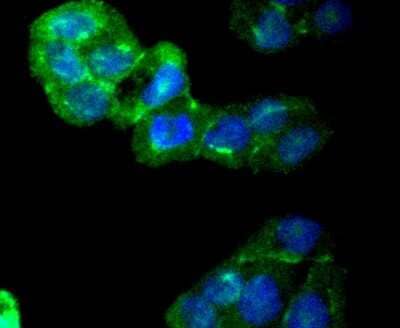 Immunocytochemistry/Immunofluorescence: CaMKII beta/gamma Antibody (SU03-57) [NBP2-67476] - Staining CaMKII in Hela cells (green). The nuclear counter stain is DAPI (blue). Cells were fixed in paraformaldehyde, permeabilised with 0.25% Triton X100/PBS.