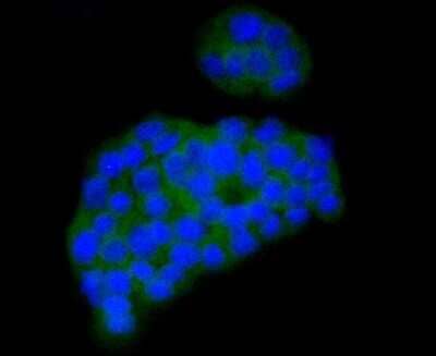 Immunocytochemistry/Immunofluorescence: CaMKII beta/gamma Antibody (SU03-57) [NBP2-67476] - Staining CaMKII in PC-12 cells (green). The nuclear counter stain is DAPI (blue). Cells were fixed in paraformaldehyde, permeabilised with 0.25% Triton X100/PBS.