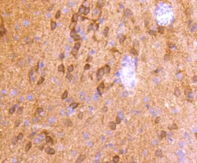 Immunohistochemistry-Paraffin: CaMKII beta/gamma Antibody (SU03-57) [NBP2-67476] - Analysis of paraffin-embedded rat brain tissue using anti-CaMKII antibody. Counter stained with hematoxylin.