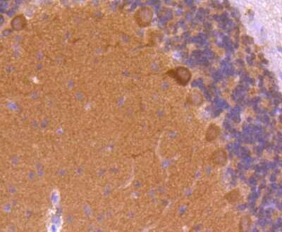Immunohistochemistry-Paraffin: CaMKII beta/gamma Antibody (SU03-57) [NBP2-67476] - Analysis of paraffin-embedded rat cerebellum tissue using anti-CaMKII antibody. Counter stained with hematoxylin.