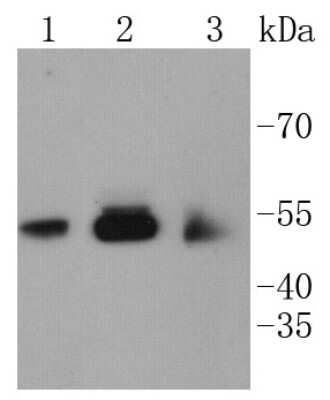 Western Blot: CaMKII beta/gamma Antibody (SU03-57) [NBP2-67476] - Analysis of CaMKII on different lysates using anti-CaMKII antibody at 1/1,000 dilution. Positive control:  Lane 1: SH-SY-5Y  Lane 2: PC-12  Lane 3: SHG-44