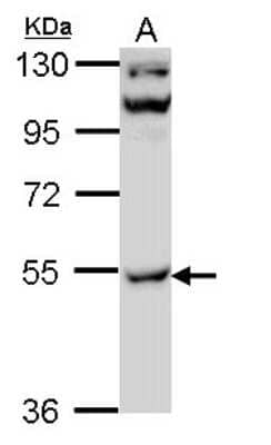 Western Blot: CaMKII gamma Antibody [NBP2-15686] - Sample (30 ug of whole cell lysate) A: Hep G2 7. 5% SDS PAGE gel, diluted at 1:1000.