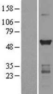 Western Blot CaM Kinase II gamma Overexpression Lysate