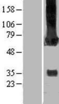 Western Blot CaM Kinase II gamma Overexpression Lysate