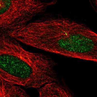 Immunocytochemistry/Immunofluorescence: CaMKIIN2 Antibody [NBP2-58609] - Staining of human cell line U-2 OS shows localization to nucleus & centrosome.
