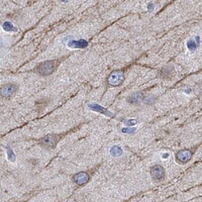 Immunohistochemistry-Paraffin: CaMKIIN2 Antibody [NBP3-17473] - Staining of human cerebral cortex shows moderate cytoplasmic positivity in neuronal cells.