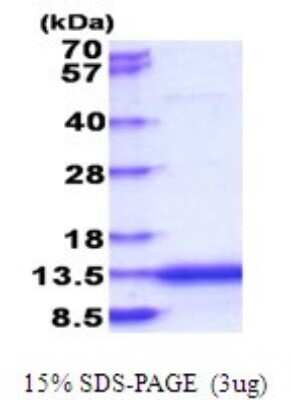 SDS-Page: CaMKIIN2 Recombinant Protein [NBP2-51788] - 15% SDS Page (3 ug)