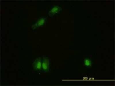 Immunocytochemistry/Immunofluorescence: CaMKIV Antibody (1A3) [H00000814-M01] - Analysis of monoclonal antibody to CAMK4 on HeLa cell. Antibody concentration 10 ug/ml.