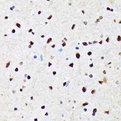 Immunohistochemistry-Paraffin: CaMKIV Antibody (1G4P4) [NBP3-16802] - Immunohistochemistry of paraffin-embedded rat brain using CaMKIV Rabbit mAb (NBP3-16802) at dilution of 1:100 (40x lens).Perform microwave antigen retrieval with 10 mM Tris/EDTA buffer pH 9.0 before commencing with IHC staining protocol.