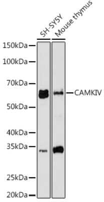 Western Blot: CaMKIV Antibody (1G4P4) [NBP3-16802] - Western blot analysis of extracts of various cell lines, using CaMKIV antibody (NBP3-16802) at 1:1000 dilution. Secondary antibody: HRP Goat Anti-Rabbit IgG (H+L) at 1:10000 dilution. Lysates/proteins: 25ug per lane. Blocking buffer: 3% nonfat dry milk in TBST. Detection: ECL Basic Kit. Exposure time: 30s.