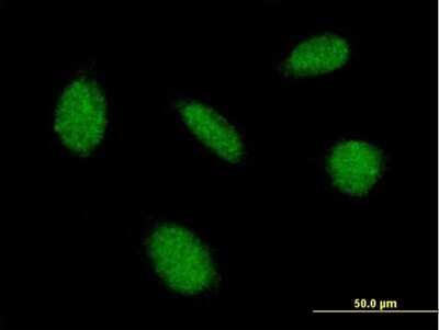 Immunocytochemistry/Immunofluorescence: CaMKIV Antibody [H00000814-B01P] - Analysis of purified antibody to CAMK4 on HeLa cell. (antibody concentration 10 ug/ml)