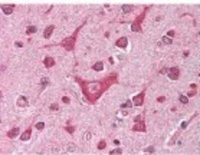 Immunohistochemistry-Paraffin: CaMKIV Antibody [NBP1-78002] - Antibody was diluted 1:500 in human brain cortex tissue. Tissue was formalin fixed and paraffin embedded. No pre-treatment of sample was required. The image shows the localization of antibody as the precipitated red signal, with a hematoxylin purple nuclear counter stain.