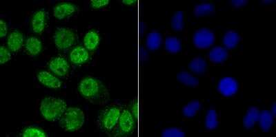 Immunocytochemistry/Immunofluorescence: CaMKIV Antibody (JB33-13) [NBP2-76979] - ICC staining CAMKIV in Hela cells (green). The nuclear counter stain is DAPI (blue). Cells were fixed in paraformaldehyde, permeabilised with 0.25% Triton X100/PBS.