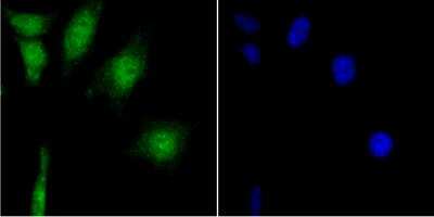 Immunocytochemistry/Immunofluorescence: CaMKIV Antibody (JB33-13) [NBP2-76979] - ICC staining CAMKIV in SH-SY-5Y cells (green). The nuclear counter stain is DAPI (blue). Cells were fixed in paraformaldehyde, permeabilised with 0.25% Triton X100/PBS.