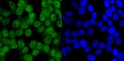 Immunocytochemistry/Immunofluorescence: CaMKIV Antibody (JB33-13) [NBP2-76979] - ICC staining CAMKIV in 293T cells (green). The nuclear counter stain is DAPI (blue). Cells were fixed in paraformaldehyde, permeabilised with 0.25% Triton X100/PBS.