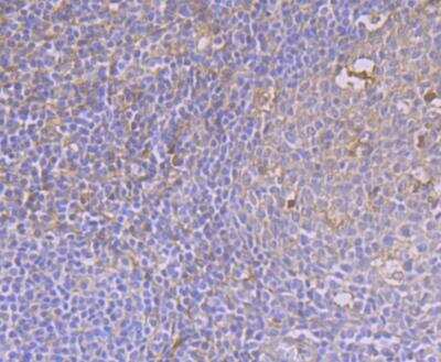 Immunohistochemistry: CaMKIV Antibody (JB33-13) [NBP2-76979] - Immunohistochemical analysis of paraffin-embedded human tonsil tissue using anti-CAMKIV antibody. Counter stained with hematoxylin.