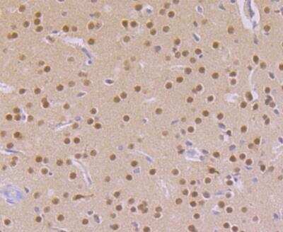 Immunohistochemistry: CaMKIV Antibody (JB33-13) [NBP2-76979] - Immunohistochemical analysis of paraffin-embedded mouse brain tissue using anti-CAMKIV antibody. Counter stained with hematoxylin.