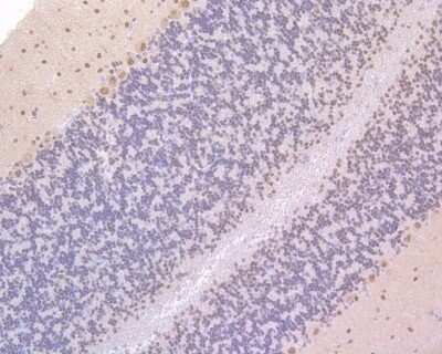 Immunohistochemistry-Paraffin: CaMKIV Antibody (JB33-13) [NBP2-76979] - Immunohistochemical analysis of paraffin-embedded rat cerebellum tissue using anti-CaMKIV antibody. The section was pre-treated using heat mediated antigen retrieval with sodium citrate buffer (pH 6.0) for 20 minutes. The tissues were blocked in 5% BSA for 30 minutes at room temperature, washed with ddH2O and PBS, and then probed with the primary antibody (1/100) for 30 minutes at room temperature. The detection was performed using an HRP conjugated compact polymer system. DAB was used as the chromogen. Tissues were counterstained with hematoxylin and mounted with DPX.