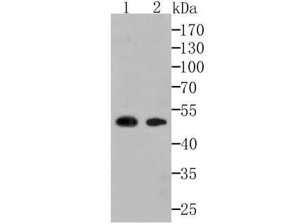 Western Blot: CaMKIV Antibody (JB33-13) [NBP2-76979] - Western blot analysis of CAMKIV on mouse brain and rat brain lysates using anti-CAMKIV antibody at 1/1,000 dilution.