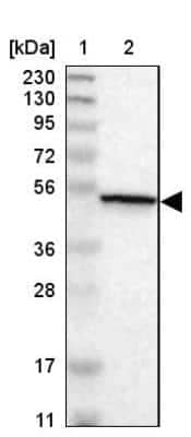 Western Blot: CaMKIV Antibody [NBP1-88209] - Lane 1: Marker  [kDa] 230, 130, 95, 72, 56, 36, 28, 17, 11.  Lane 2: Human cell line RT-94