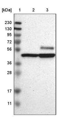 Western Blot: CaMKIV Antibody [NBP1-88210] - Lane 1: Marker  [kDa] 230, 130, 95, 72, 56, 36, 28, 17, 11.  Lane 2: Human cell line RT-4.  Lane 3: Human cell line U-251MG sp