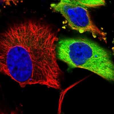 Immunocytochemistry/Immunofluorescence: CaMKK alpha Antibody [NBP1-88208] - CaMKK Antibody [NBP1-88208] - Staining of human cell line U-251MG shows positivity in cytoplasm. Antibody staining shown in green.