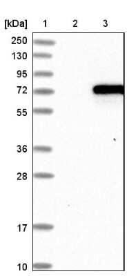 Western Blot: CaMKK alpha Antibody [NBP1-88208] - CaMKK Antibody [NBP1-88208] - Lane 1: Marker [kDa] 250, 130, 95, 72, 55, 36, 28, 17, 10Lane 2: Negative control (vector only transfected HEK293T lysate)Lane 3: Over-expression lysate (Co-expressed with a C-terminal myc-DDK tag (~3.1 kDa) in mammalian HEK293T cells).