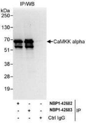 Immunoprecipitation: CaMKK alpha Antibody [NBP1-42682] - Whole cell lysate (1 mg for IP, 20% of IP loaded) from HeLa cells.  Antibodies: Affinity purified rabbit anti-CaMKK alpha antibody  used for IP at 3 mcg/mg lysate.  CaMKK alpha was also immunoprecipitated by rabbit anti-CaMKK alpha antibody NBP1-42683, which recognizes a downstream epitope.