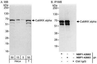 Western Blot: CaMKK alpha Antibody [NBP1-42683] - Whole cell lysate from HeLa (5, 15 and 50 mcg for WB; 1 mg for IP, 20% of IP loaded) and 293T (T; 50 mcg) cells.  Antibodies: Affinity purified rabbit anti-CaMKK alpha antibody used for WB at 0.04 mcg/ml (A) and 1 mcg/ml (B) and used for IP at 3 mcg/mg lysate.  CaMKK alpha was also immunoprecipitated by rabbit anti-CaMKK alpha antibody NBP1-42682, which recognizes an upstream epitope.