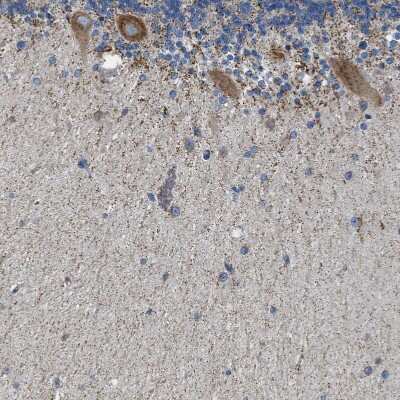 Immunohistochemistry-Paraffin CaMKK2 Antibody - BSA Free