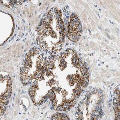 Immunohistochemistry-Paraffin CaMKK2 Antibody - BSA Free