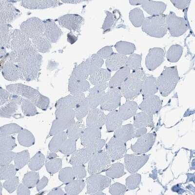 Immunohistochemistry-Paraffin: CaMKK2 Antibody [NBP1-86651] - Staining of human skeletal muscle shows no positivity in myocytes as expected.