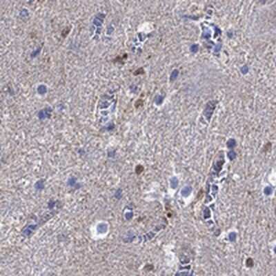 Immunohistochemistry-Paraffin: CaMKK2 Antibody [NBP3-17692] - Staining of human cerebellum shows cytoplasmic positivity in dentate nucleus.