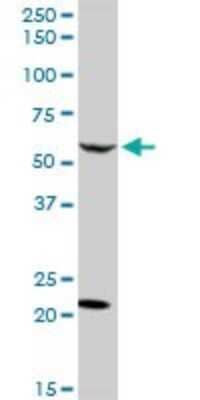 Western Blot: CaMKK2 Antibody [H00010645-D01P] - Analysis of CAMKK2 expression in HeLa.