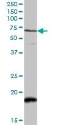 Western Blot: CaMKK2 Antibody [H00010645-D01P] - Analysis of CAMKK2 expression in mouse kidney.