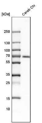 Western Blot: CaMKK2 Antibody [NBP1-86651] - Analysis in human cerebral cortex tissue.