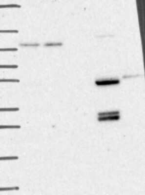 Western Blot: CaMKK2 Antibody [NBP3-17692] - Lane 1: Marker [kDa] 250, 130, 95, 72, 55, 36, 28, 17, 10;   Lane 2: RT4;   Lane 3: U-251 MG;   Lane 4: Human Plasma;   Lane 5: Liver;   Lane 6: Tonsil