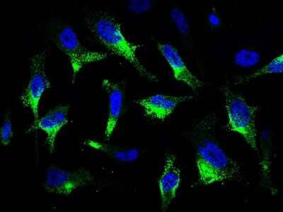 Immunocytochemistry/Immunofluorescence: CaMKV Antibody [NBP2-99963] - Immunofluorescence staining of CaMKV in HeLa cells. Cells were fixed with 4% PFA, permeabilzed with 0.3% Triton X-100 in PBS, blocked with 10% serum, and incubated with rabbit anti-human CaMKV polyclonal antibody (1:1000) at 4C overnight. Then cells were stained with the Alexa Fluor(R)488-conjugated Goat Anti-rabbit IgG secondary antibody (green) and counterstained with DAPI (blue). Positive staining was localized to cytoplasm.